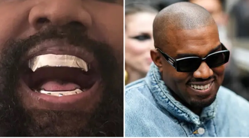 Kanye West Replaces Teeth